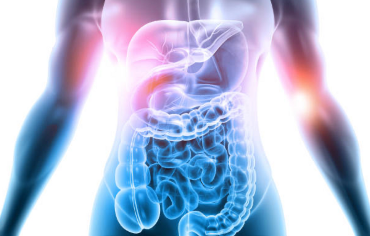 Gut integrity support
