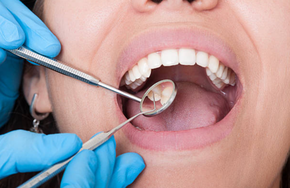 Healthy mouth environment