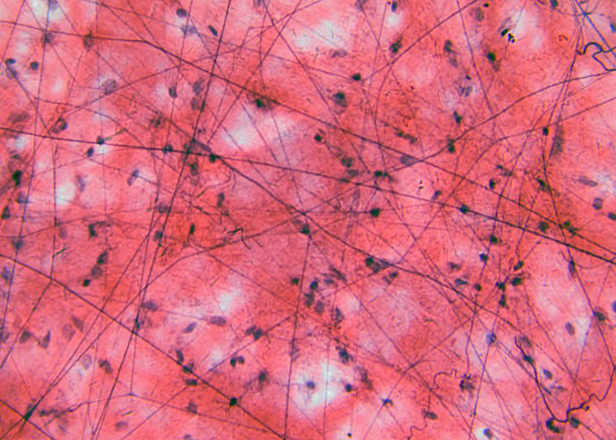 Connective tissue resilience