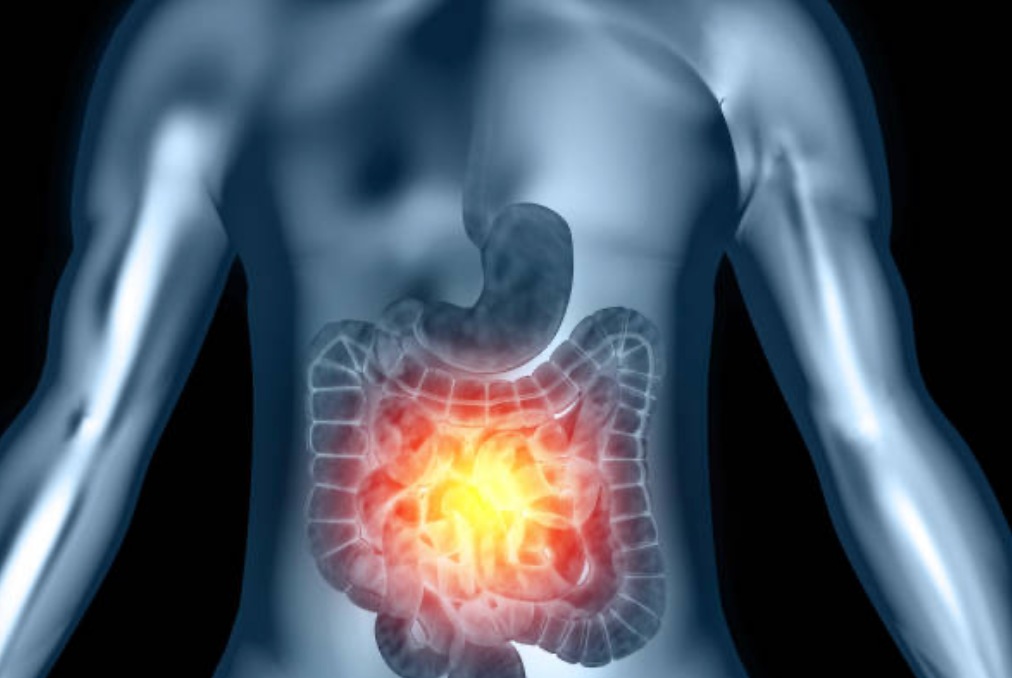 Digestive health & antioxidant protection