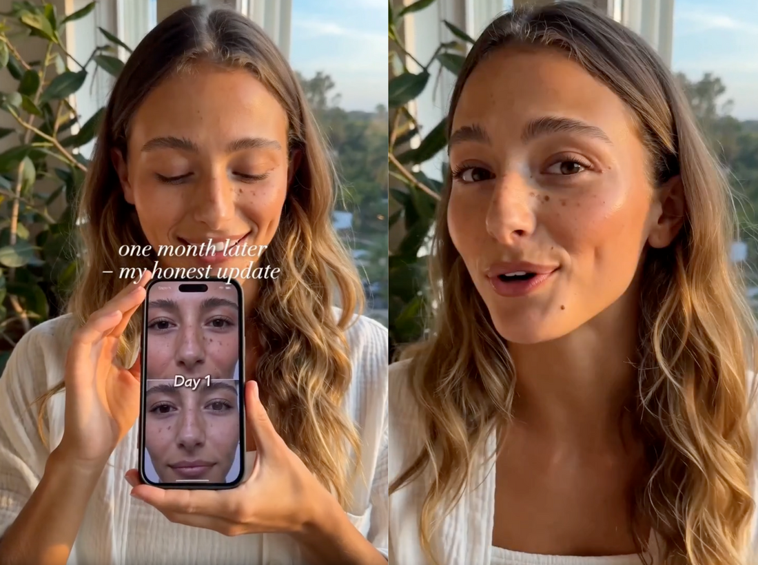 GoTime Skin Results