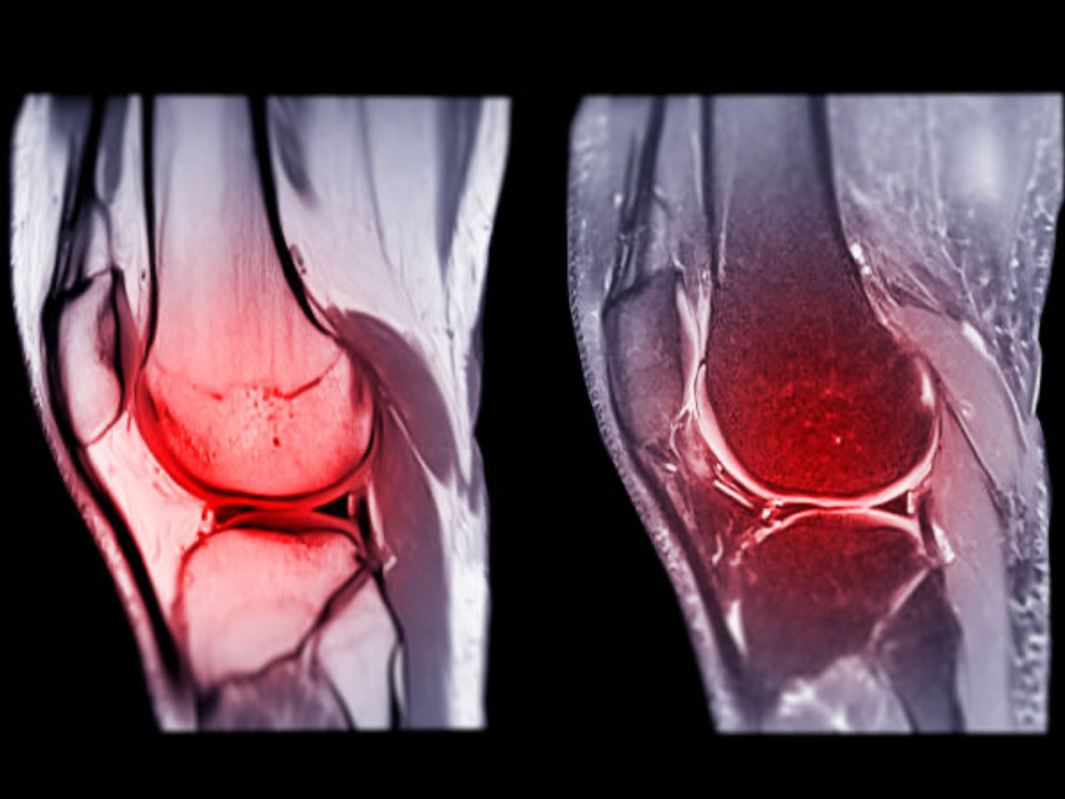 Mobility
